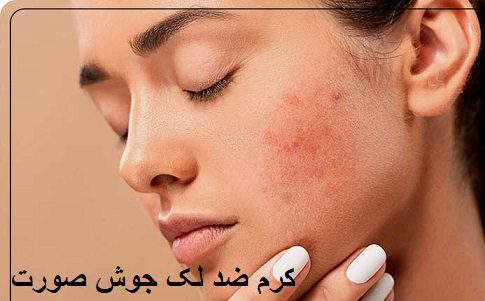 کرم ضد لک جوش صورت 4 کرم ضد لک جوش صورت