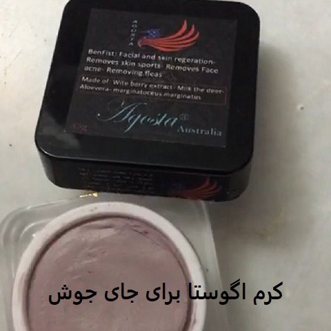 کرم اگوستا برای جای جوش 1 کرم اگوستا برای جای جوش